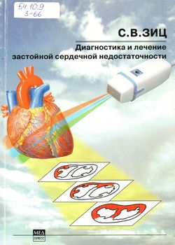 Диагностика и лечение застойной сердечной недостаточности